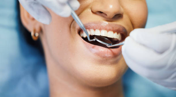 Best Emergency Dentist for Knocked-Out Tooth in Red Oaks Mill, NY